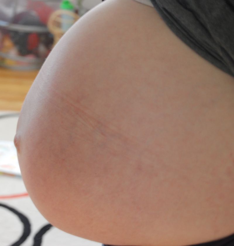 Belly